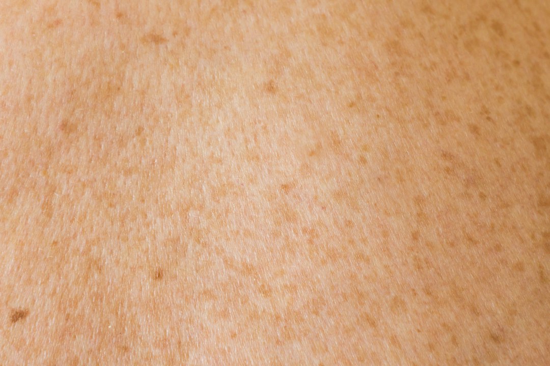 What Causes Dull, Tired-Looking Skin: The Science Behind Loss of Radiance