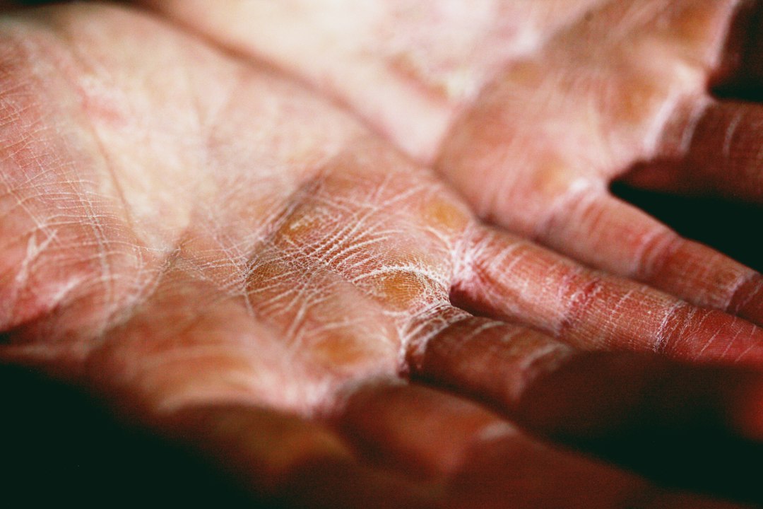 Fine Lines and Wrinkles: Why They Appear Earlier and How to Slow Their Development